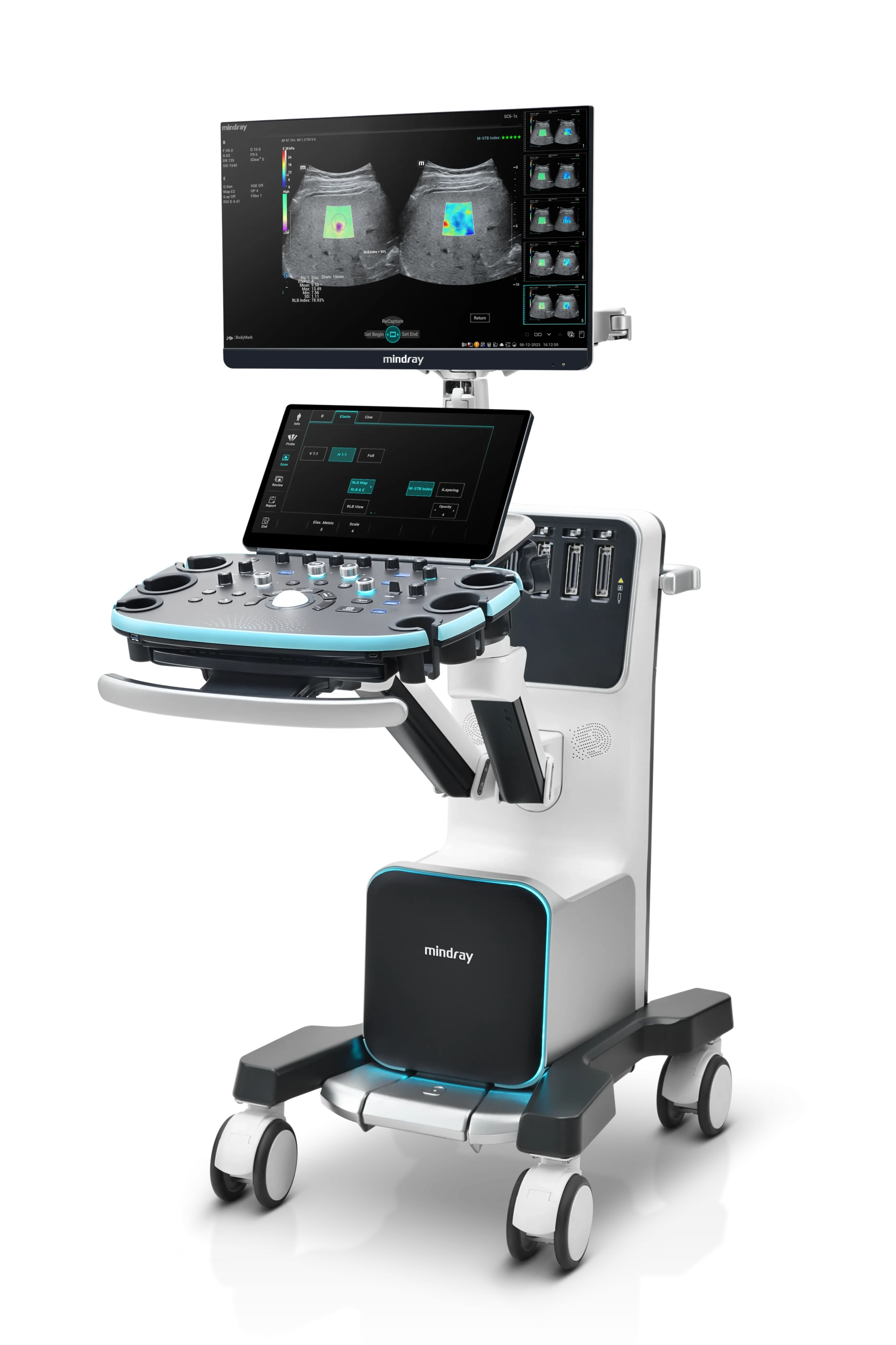 Mindray Resona I9
